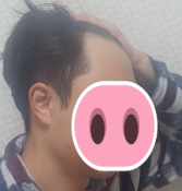 전 2.PNG