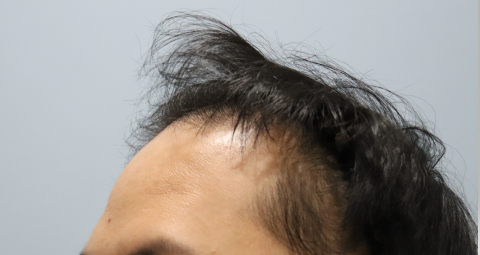 2.PNG