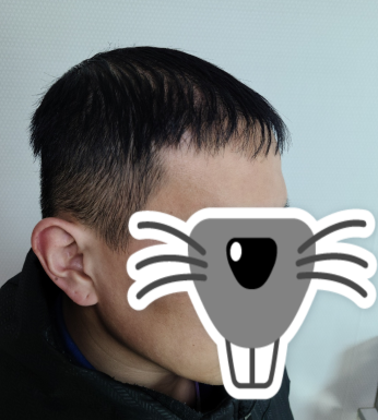 후 4.PNG