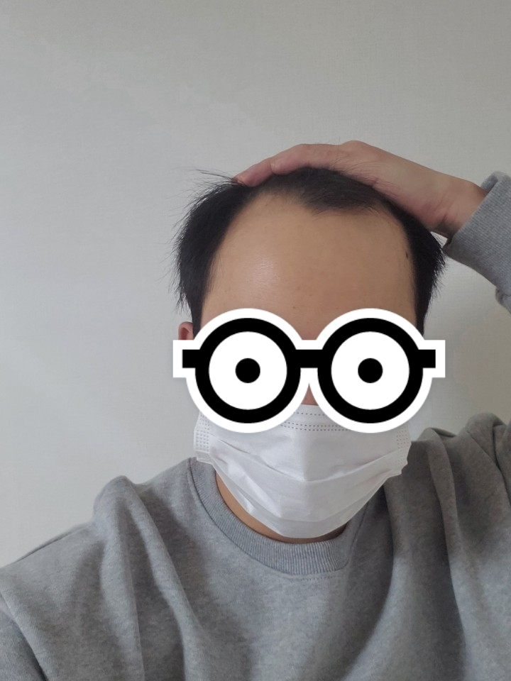 박인목 수술 전 1.png