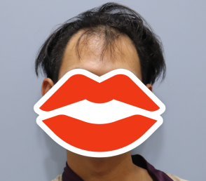 전 1.PNG