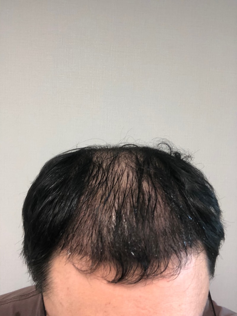 후2.jpg