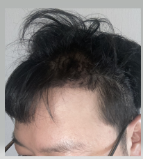 1.PNG