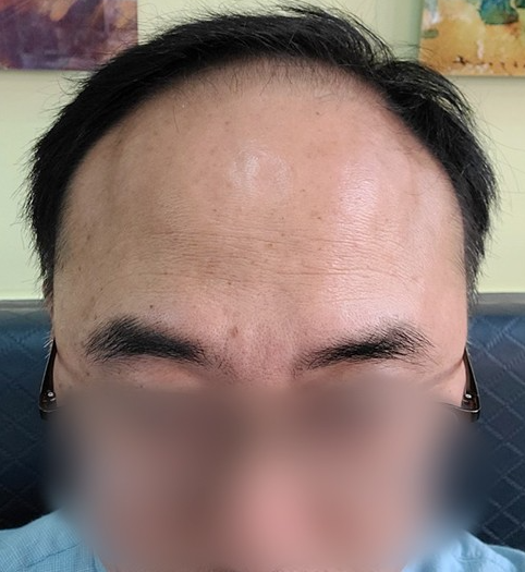 정동희 수술 전.PNG