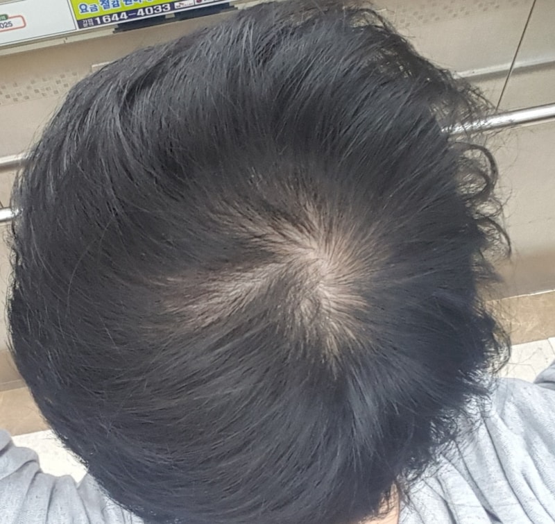 20170425_124104.jpg