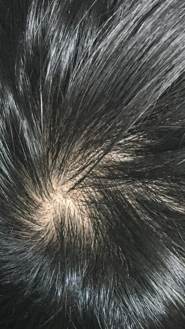 731F5E9F-19F1-4D90-AC57-D419932635A5.png