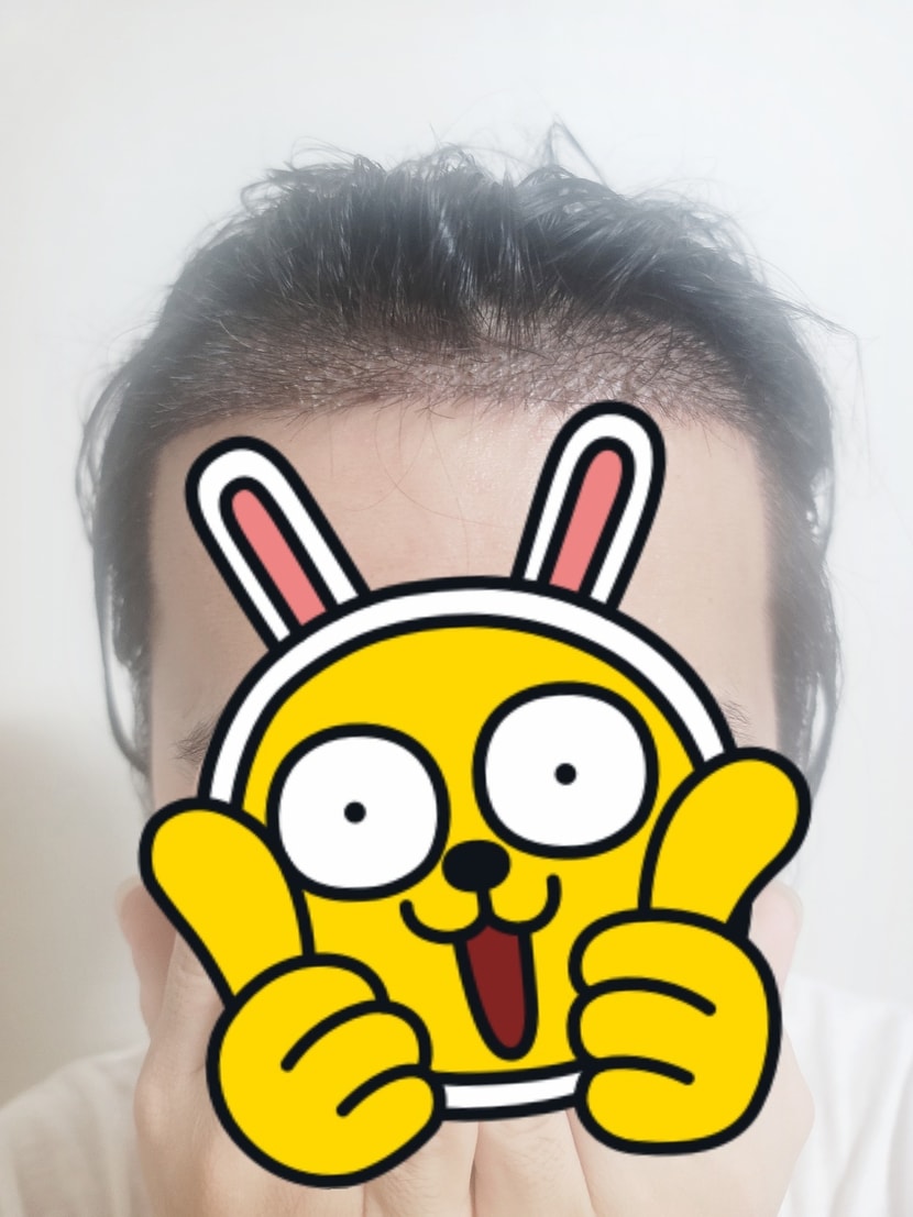 현재 사진들