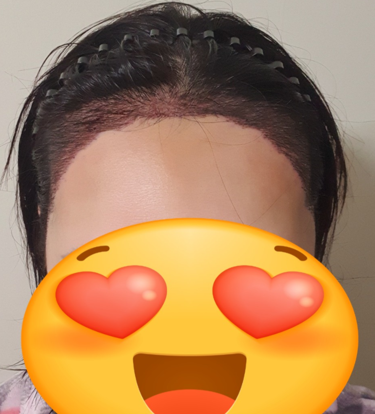 후 1.PNG
