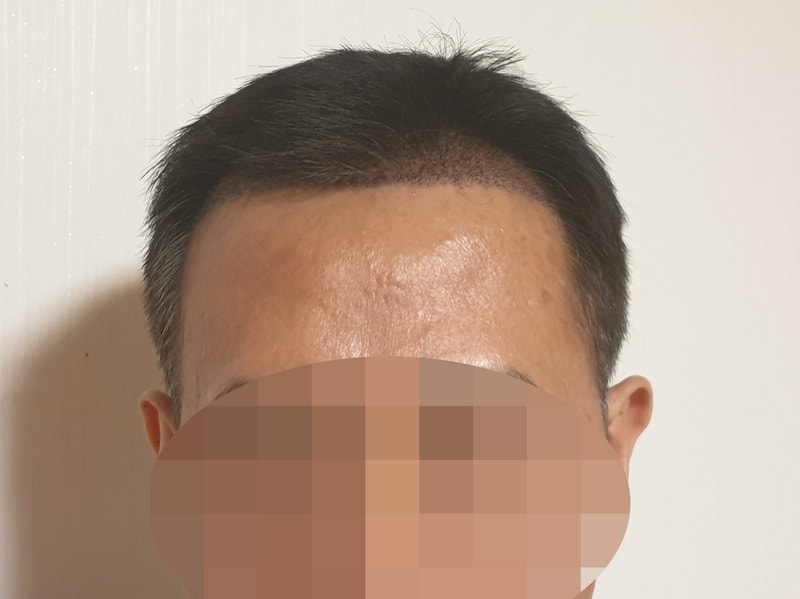 후3.jpg