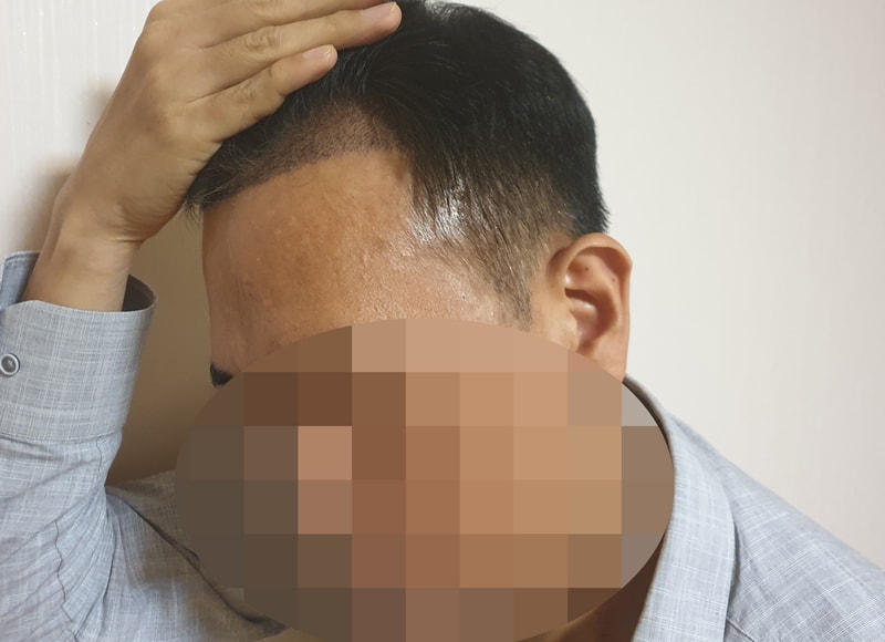 후2.jpg
