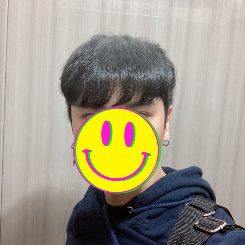 프로스카복용6개월 내렸을때