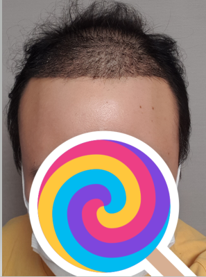후 1.PNG