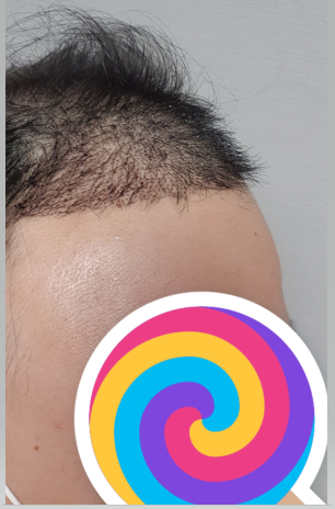 후 2.PNG
