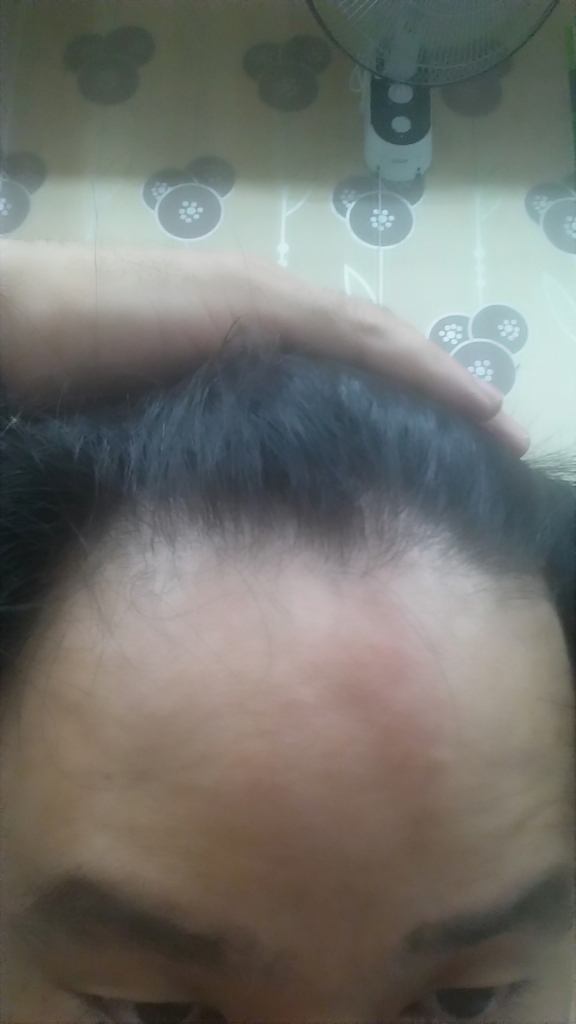 20150925_172405.jpg