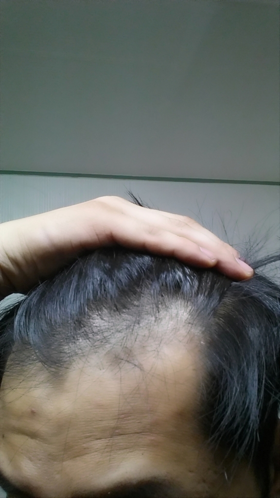 20150424_001952.jpg