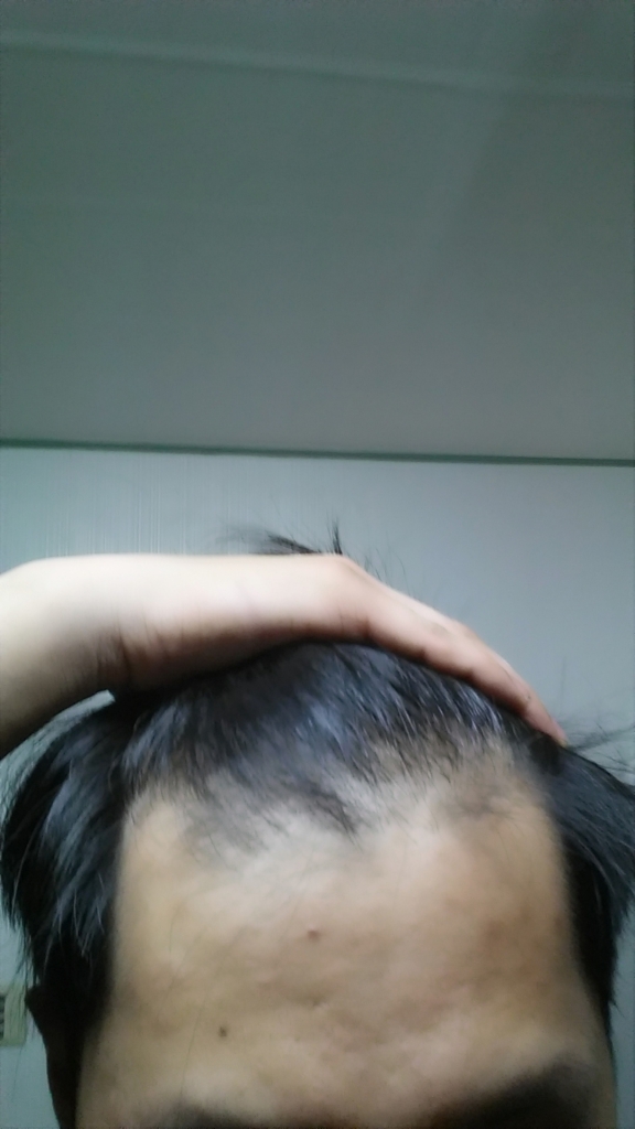20150424_002020.jpg