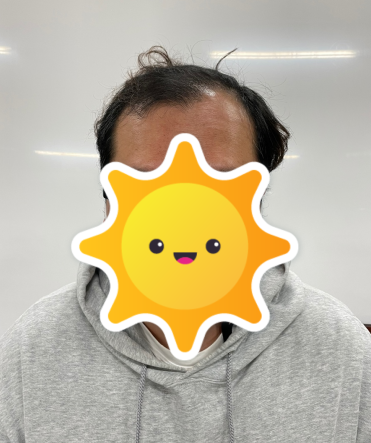 박성진 수술 전.PNG