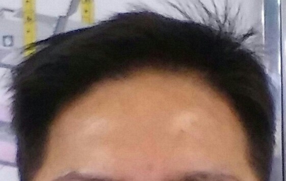 ㅋ