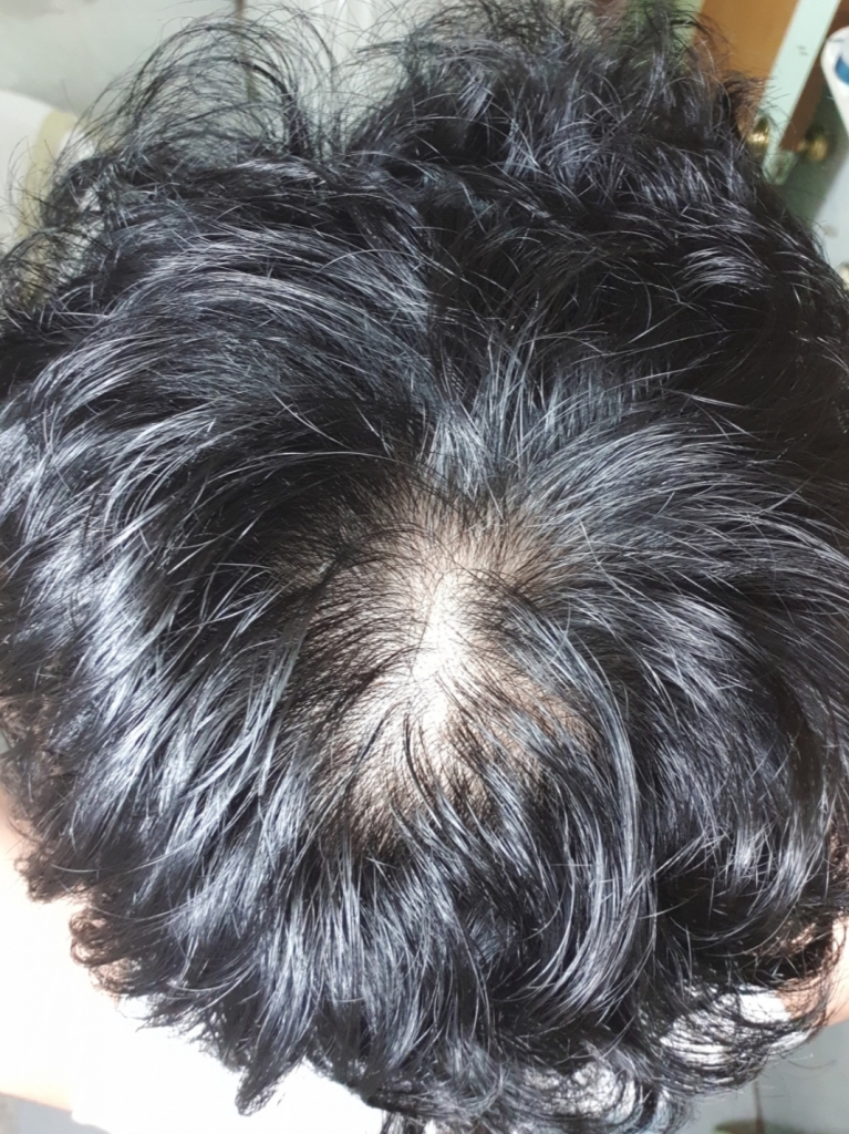 20180921_050709.jpg