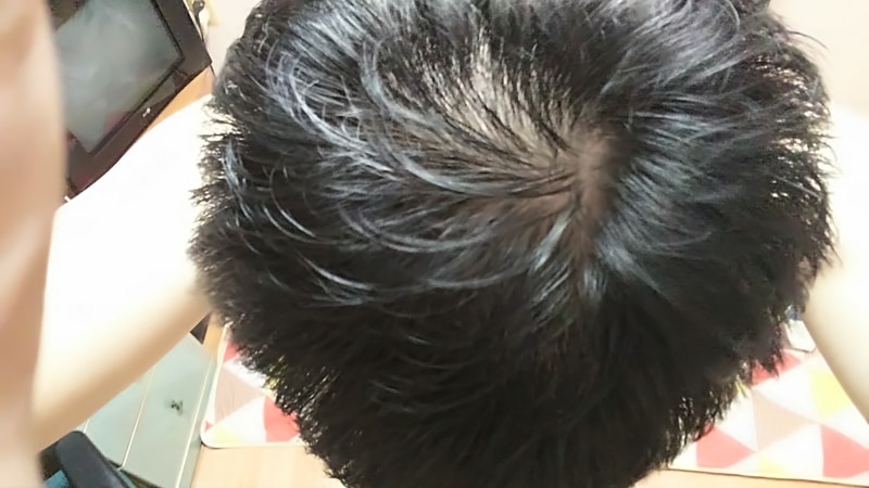 KakaoTalk_20170802_103907236.jpg