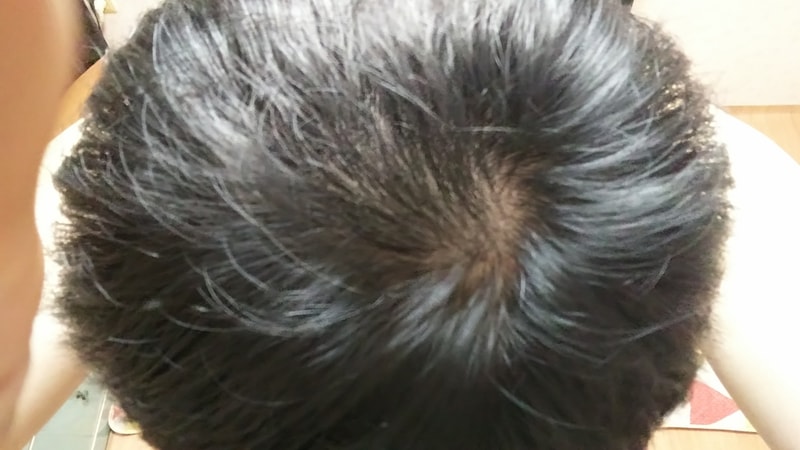KakaoTalk_20170802_103905884.jpg