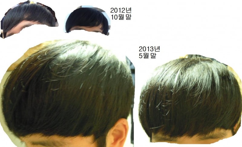 앞머리.JPG