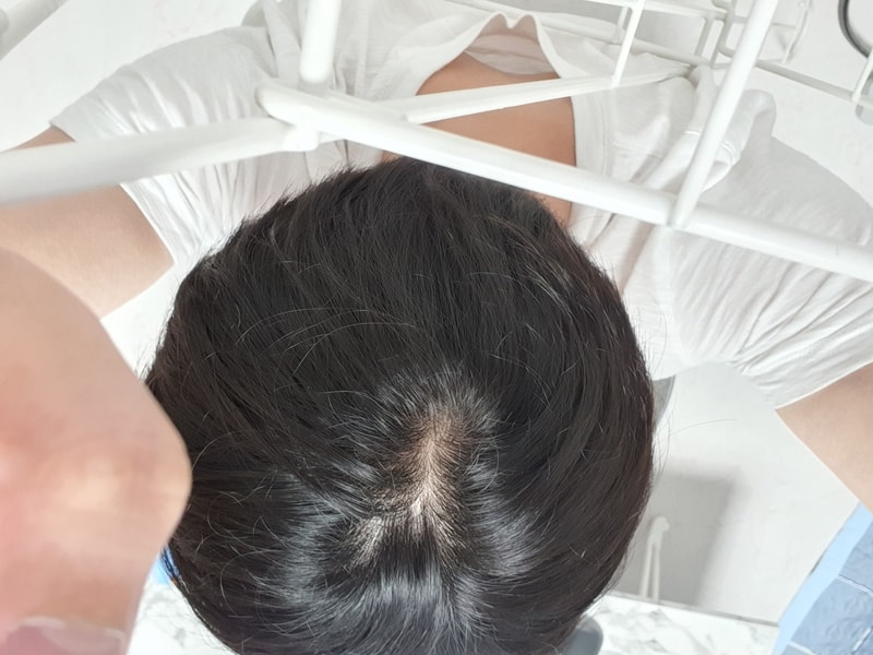 머리 가마_최규재.jpg