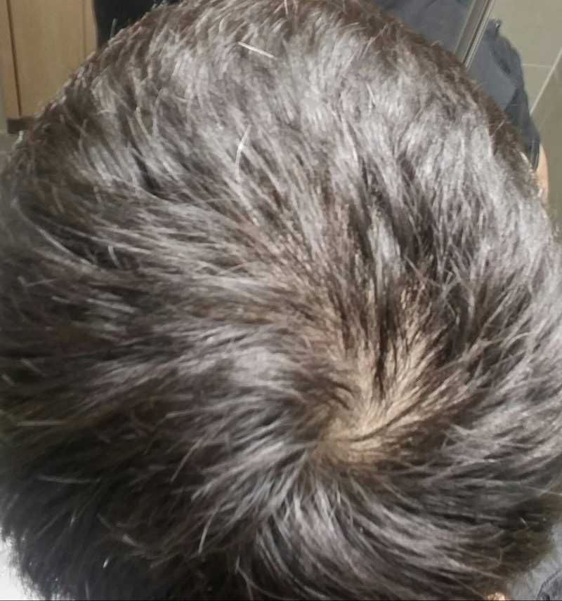 20180301_212855_HDR-1.jpg