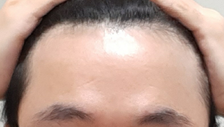 B612_20210210_041659_889.jpg
