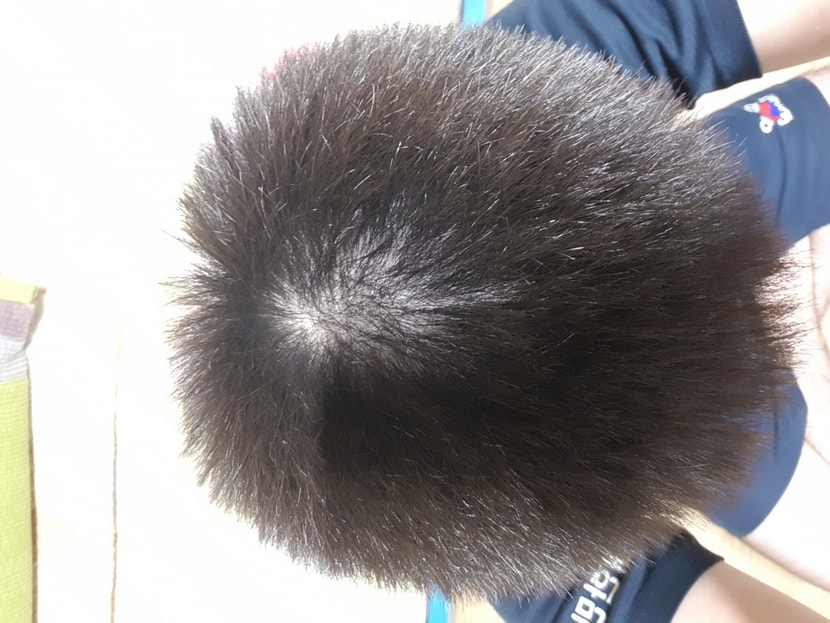 23년 11월 20일 윗머리