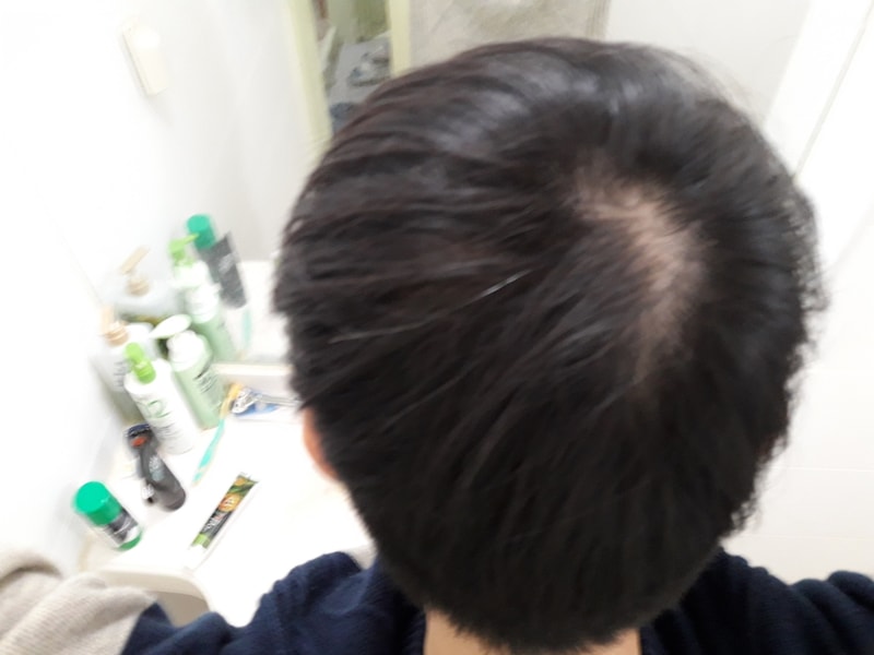 20171211_205957.jpg