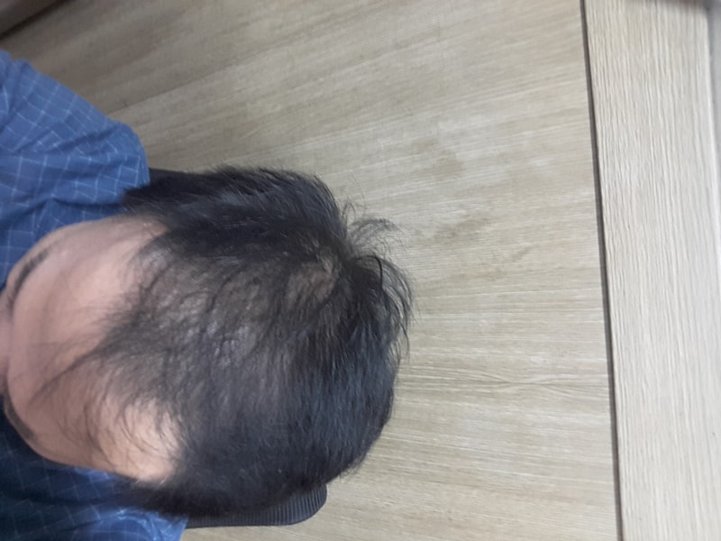 KakaoTalk_20170918_054814384.jpg