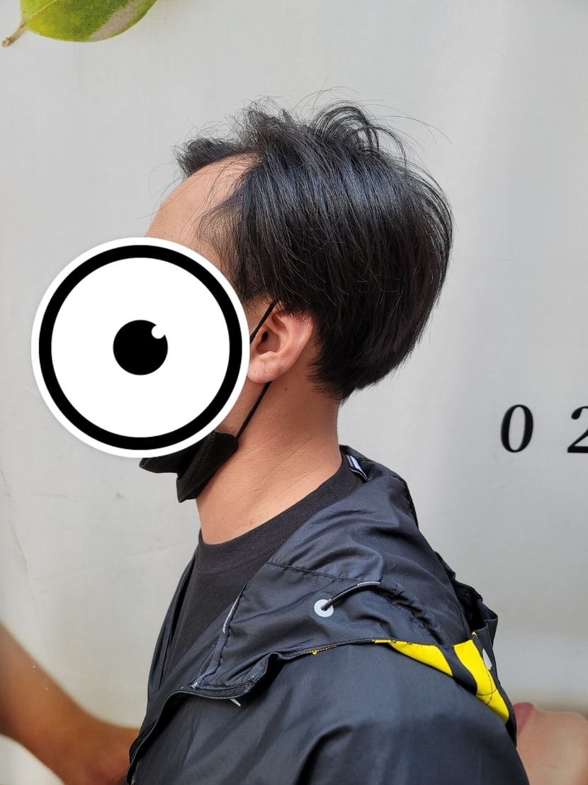 수술전