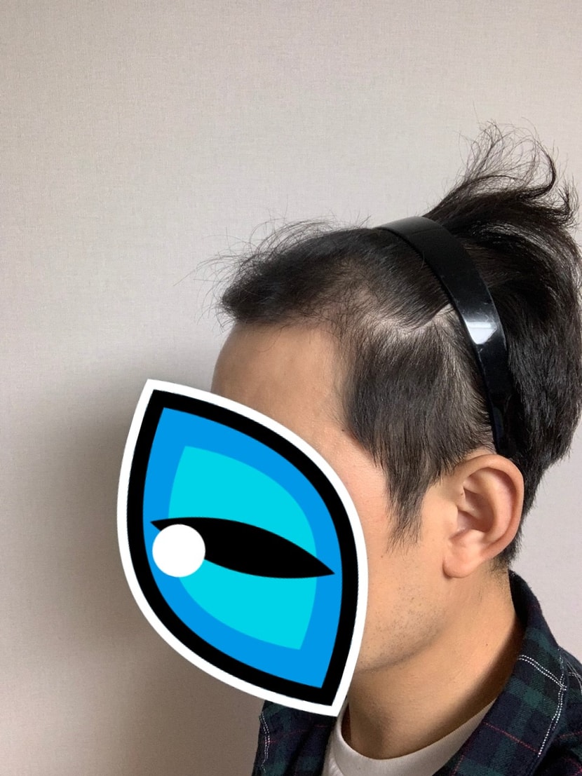 수술전
