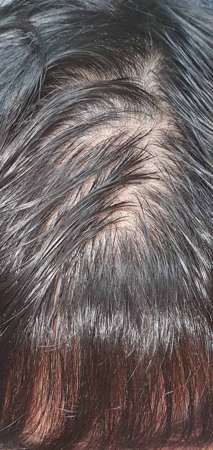 Screenshot_20200821-224742_Gallery.jpg
