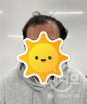a0e6eb73107b557412daa2eee0e4a9d5.png