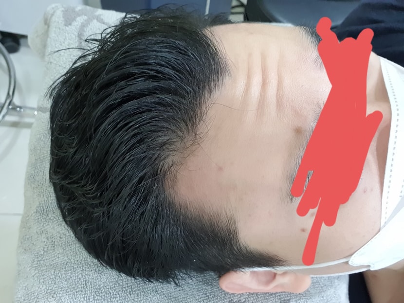 왼쪽