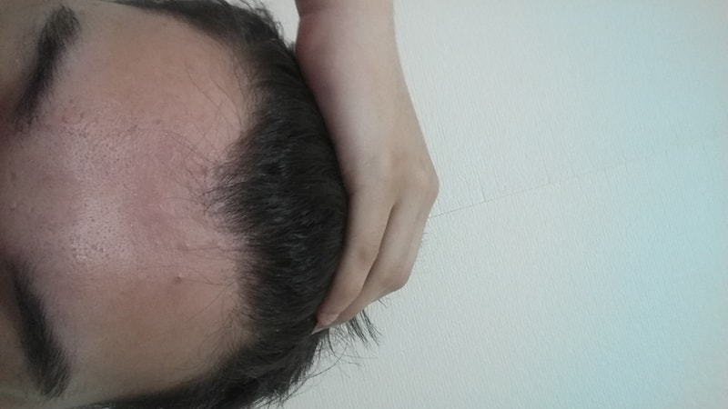 20180322_194506.jpg