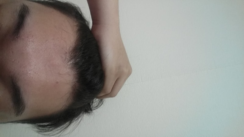 20180322_194432.jpg