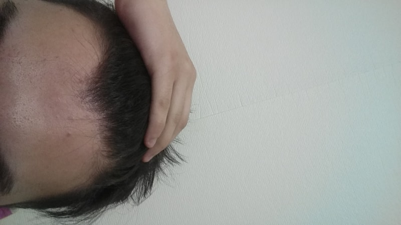 20180322_194454.jpg