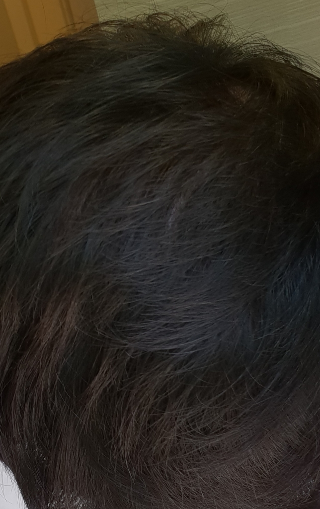 20180817_154747.jpg