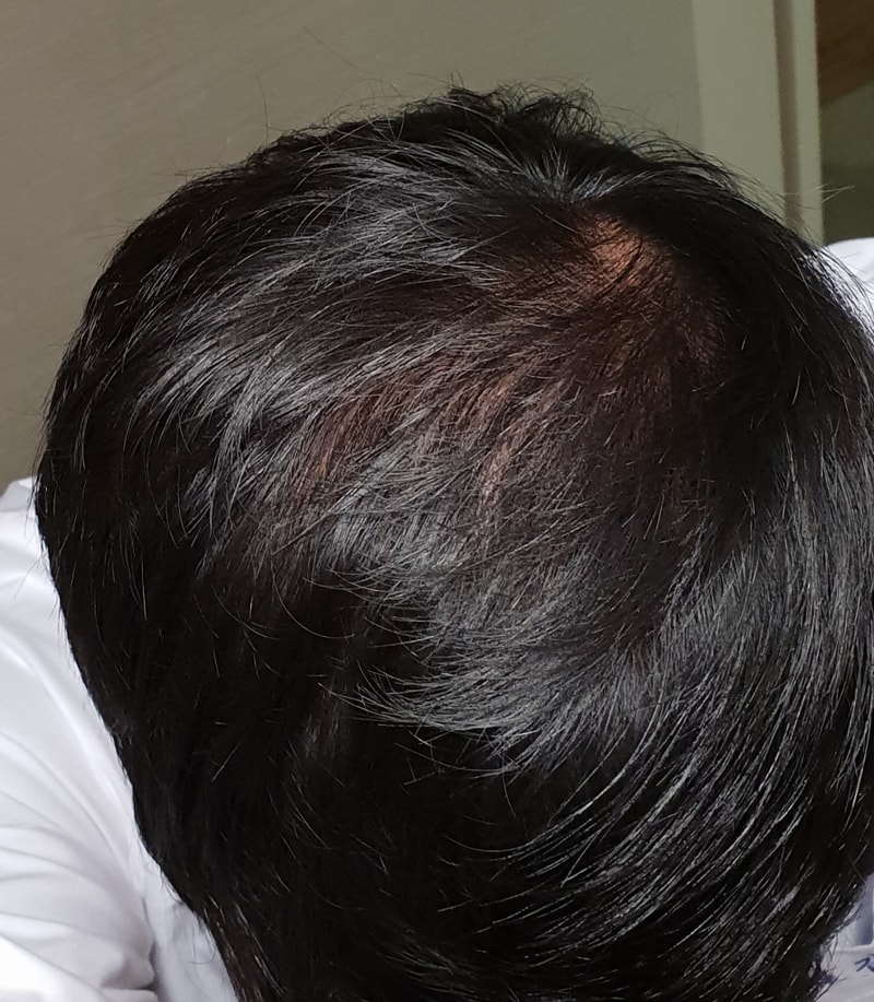 20180817_154805.jpg