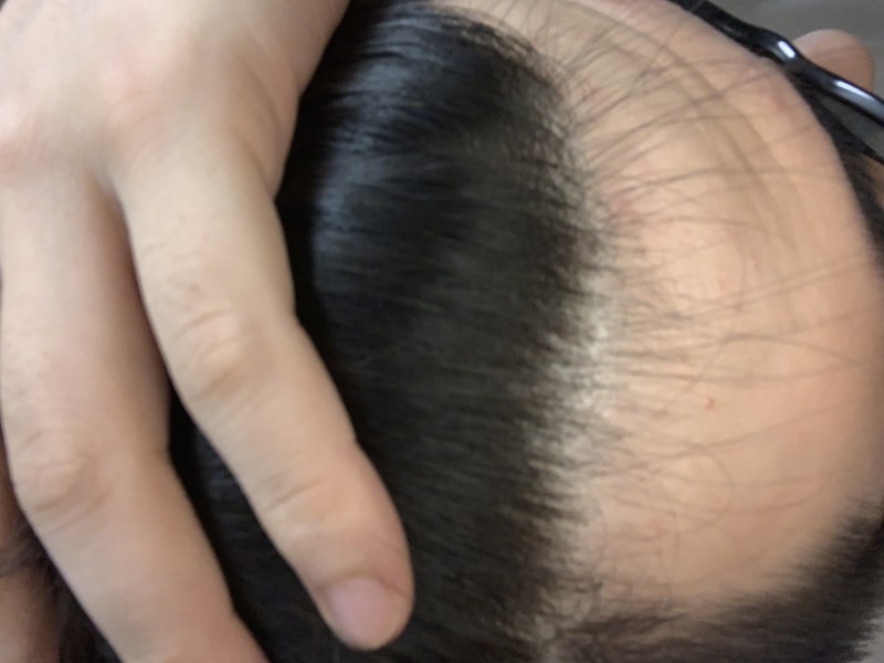 34DD3E8D-7A23-40A6-9799-8E4A2BBED0ED.jpeg