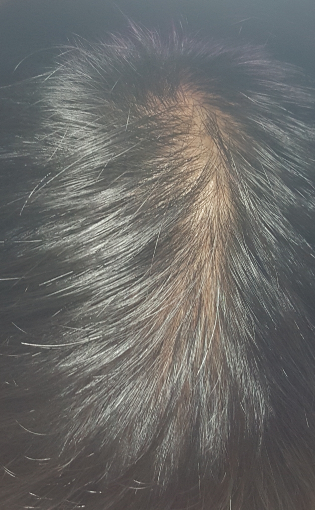20170820_212442.png