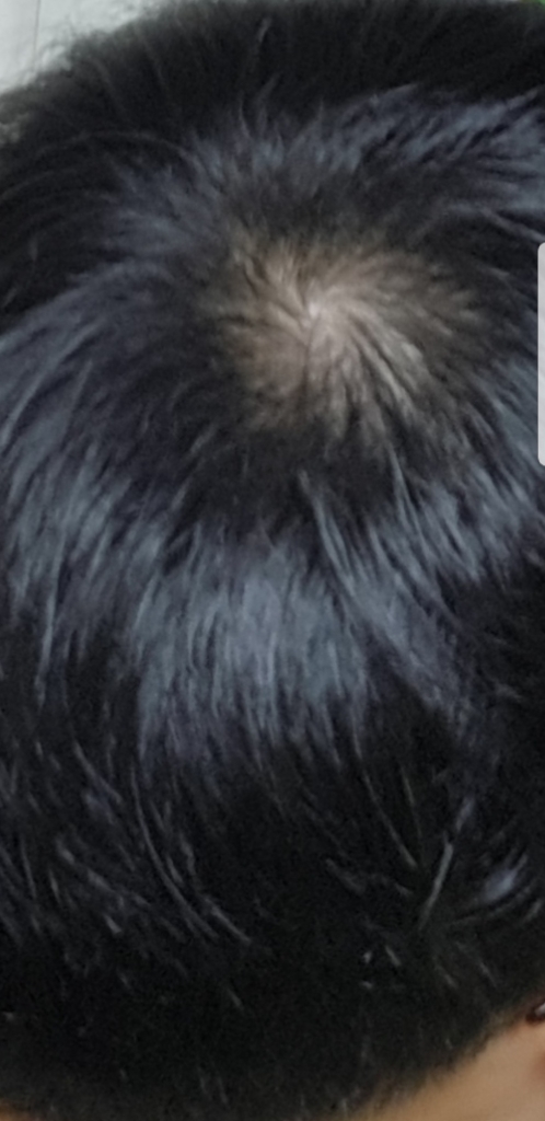 Screenshot_20180913-000534_Gallery.jpg