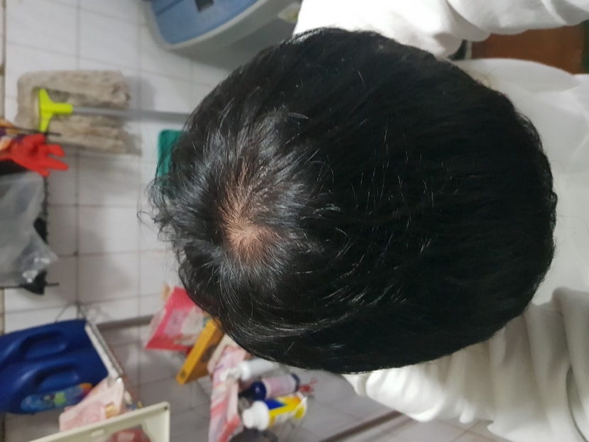 머리감고 나서 말린후