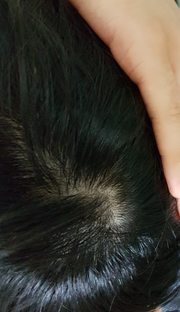 20170612_211953.jpg