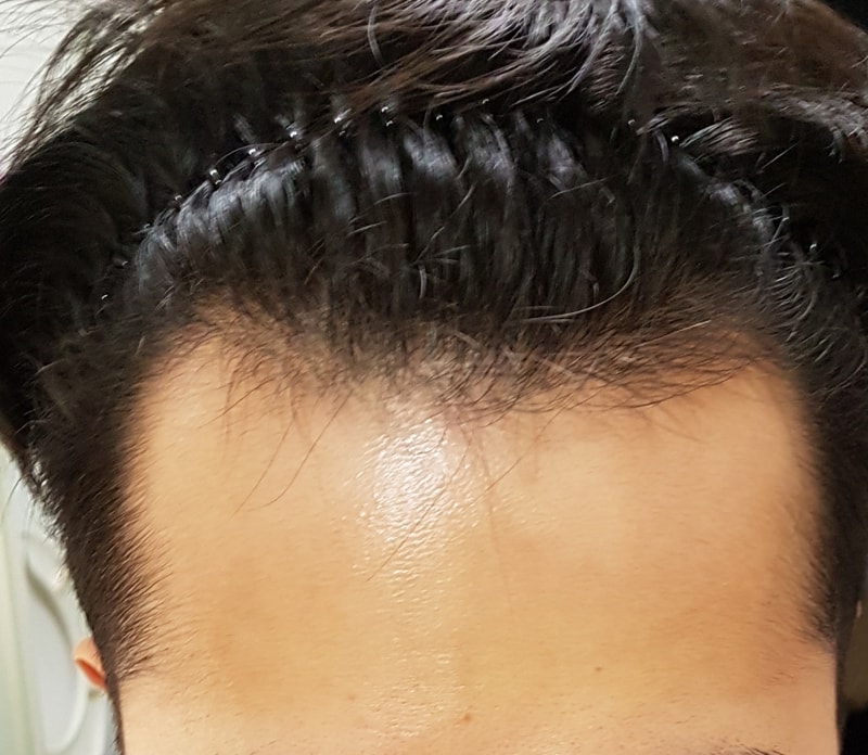 20170612_211812.jpg