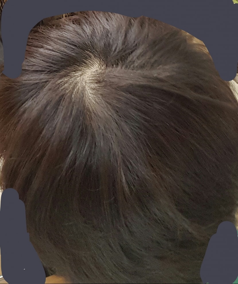 오늘사진