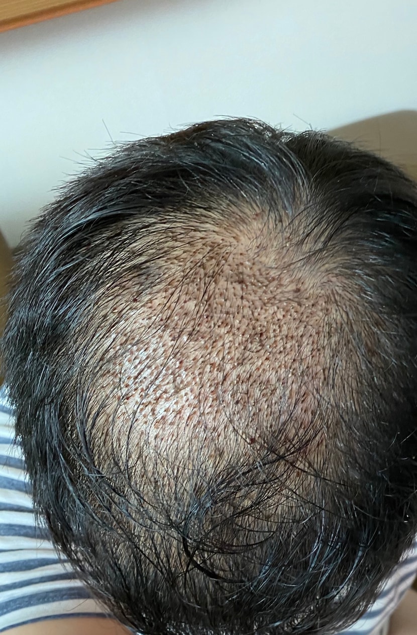 일주일후